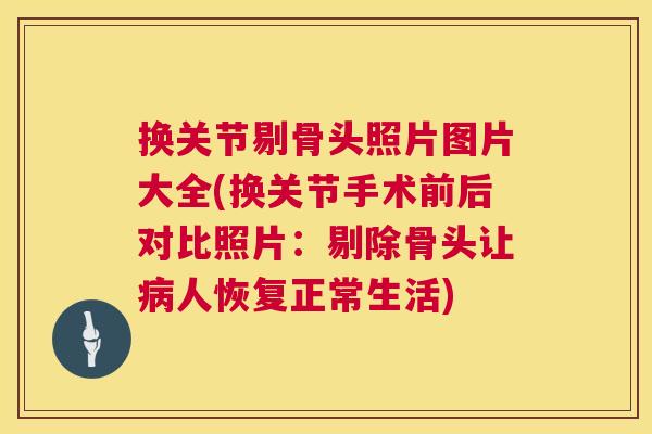 换关节剔骨头照片图片大全(换关节手术前后对比照片：剔除骨头让病人恢复正常生活)