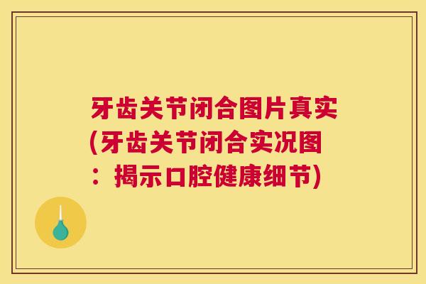 牙齿关节闭合图片真实(牙齿关节闭合实况图：揭示口腔健康细节)