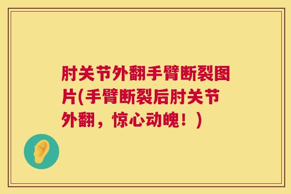 肘关节外翻手臂断裂图片(手臂断裂后肘关节外翻，惊心动魄！)