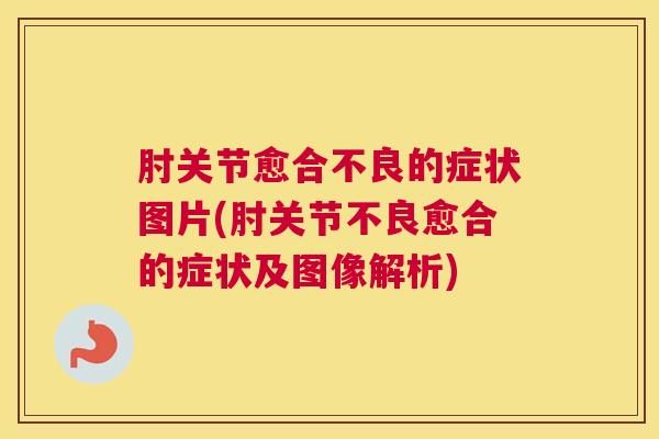 肘关节愈合不良的症状图片(肘关节不良愈合的症状及图像解析)