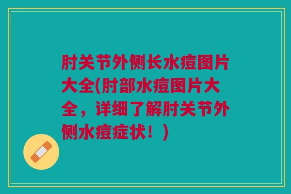 肘关节外侧长水痘图片大全(肘部水痘图片大全，详细了解肘关节外侧水痘症状！)