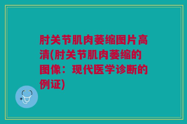 肘关节肌肉萎缩图片高清(肘关节肌肉萎缩的图像：现代医学诊断的例证)