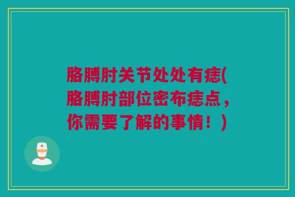 胳膊肘关节处处有痣(胳膊肘部位密布痣点，你需要了解的事情！)
