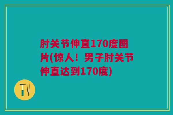 肘关节伸直170度图片(惊人！男子肘关节伸直达到170度)