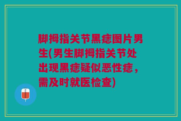 脚拇指关节黑痣图片男生(男生脚拇指关节处出现黑痣疑似恶性痣，需及时就医检查)