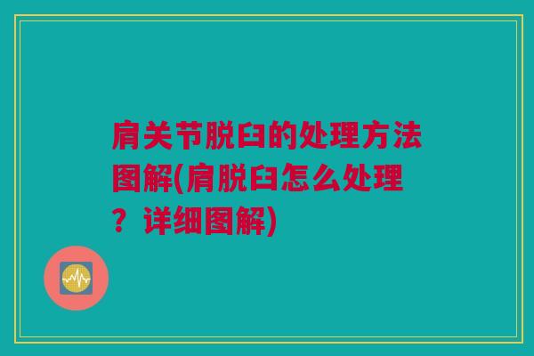 肩关节脱臼的处理方法图解(肩脱臼怎么处理？详细图解)