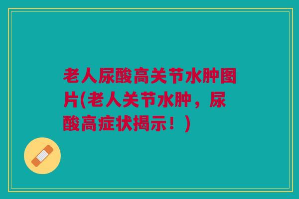 老人尿酸高关节水肿图片(老人关节水肿，尿酸高症状揭示！)