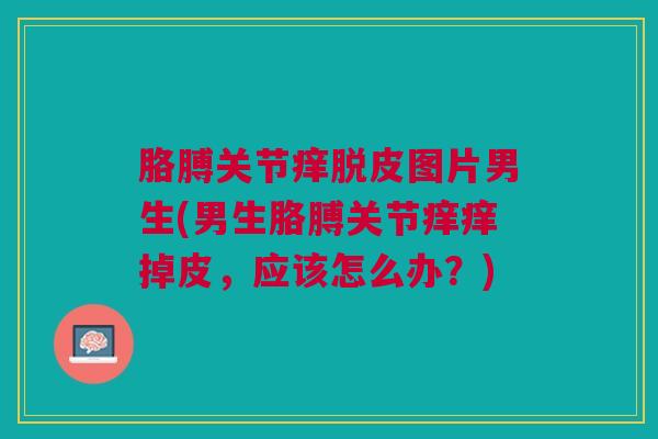 胳膊关节痒脱皮图片男生(男生胳膊关节痒痒掉皮，应该怎么办？)