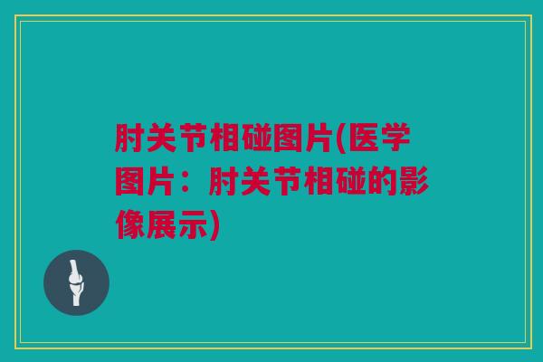 肘关节相碰图片(医学图片：肘关节相碰的影像展示)