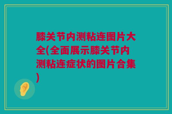 膝关节内测粘连图片大全(全面展示膝关节内测粘连症状的图片合集)