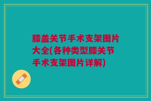 膝盖关节手术支架图片大全(各种类型膝关节手术支架图片详解)