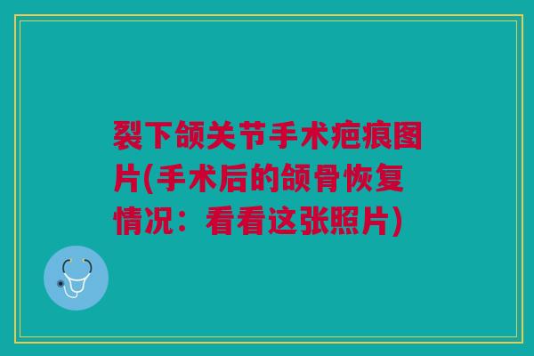裂下颌关节手术疤痕图片(手术后的颌骨恢复情况：看看这张照片)