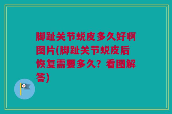 脚趾关节蜕皮多久好啊图片(脚趾关节蜕皮后恢复需要多久？看图解答)