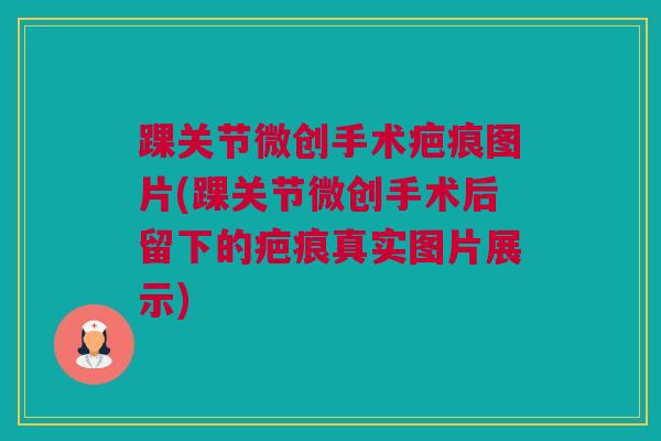 踝关节微创手术疤痕图片(踝关节微创手术后留下的疤痕真实图片展示) 踝关节微创手术疤痕图片(踝关节微创手术后留下的疤痕真实图片展示)