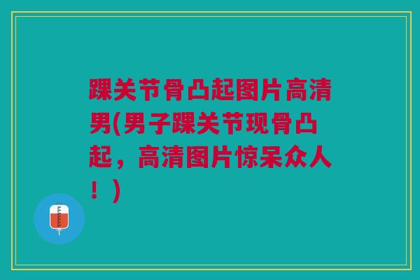 踝关节骨凸起图片高清男(男子踝关节现骨凸起，高清图片惊呆众人！)