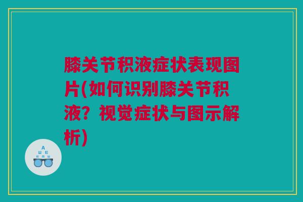 膝关节积液症状表现图片(如何识别膝关节积液？视觉症状与图示解析)