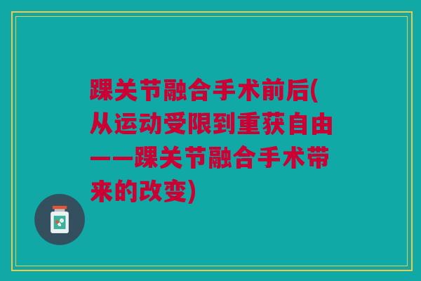踝关节融合手术前后(从运动受限到重获自由——踝关节融合手术带来的改变) 踝关节融合手术前后(从运动受限到重获自由——踝关节融合手术带来的改变)