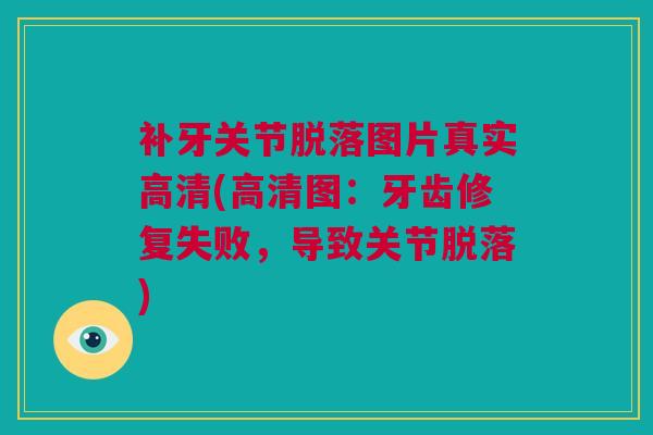 补牙关节脱落图片真实高清(高清图：牙齿修复失败，导致关节脱落)