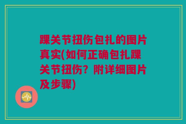 踝关节扭伤包扎的图片真实(如何正确包扎踝关节扭伤?附详细图片及步骤) 踝关节扭伤包扎的图片真实(如何正确包扎踝关节扭伤?附详细图片及步骤)