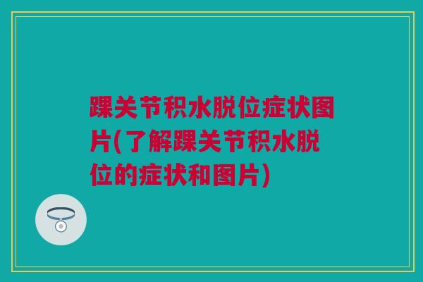 踝关节积水脱位症状图片(了解踝关节积水脱位的症状和图片)